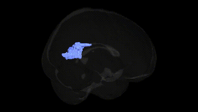 Full Brain Black