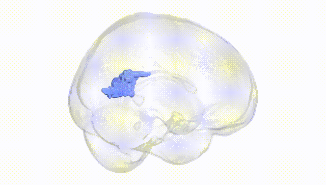 Full Brain White