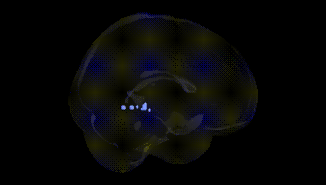Full Brain Black