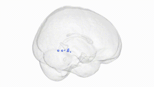 Full Brain White