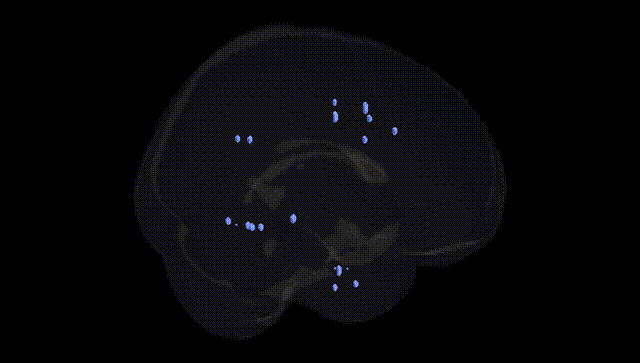 Full Brain Black