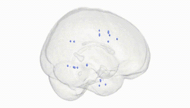 Full Brain White
