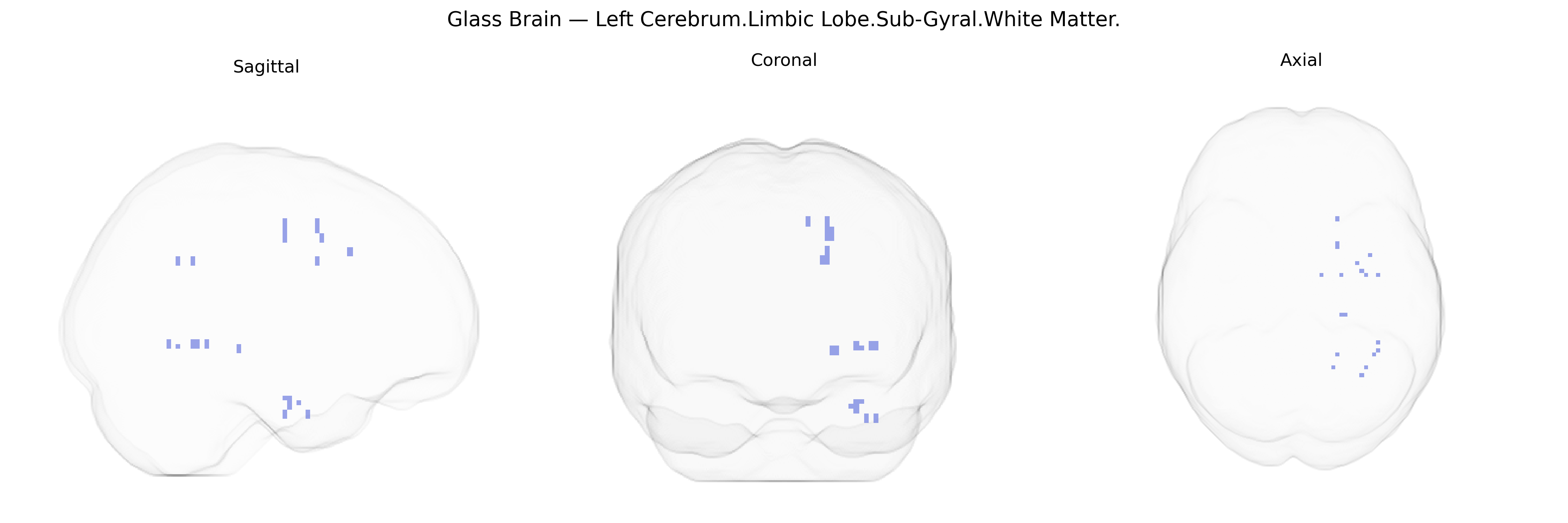 Triplanar Ghost Brain
