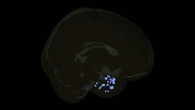 Full Brain Black