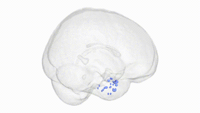 Full Brain White