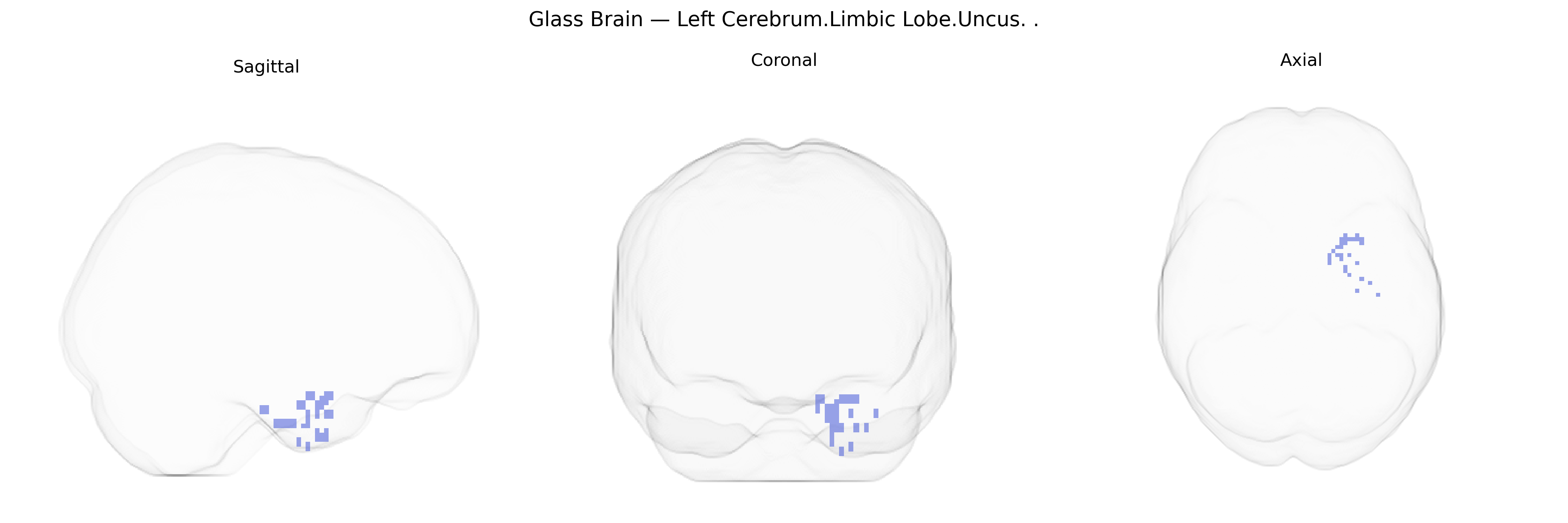Triplanar Ghost Brain