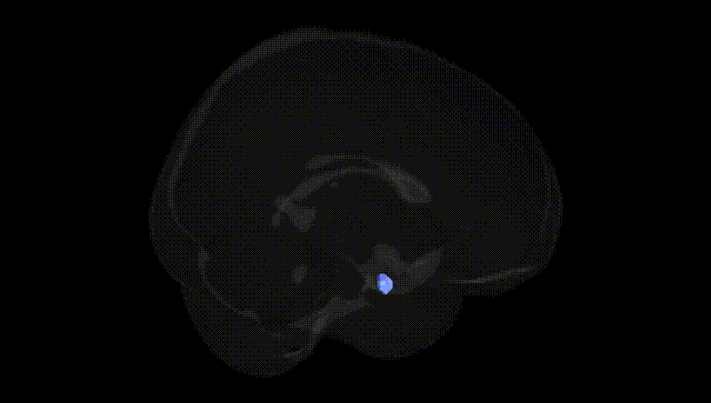Full Brain Black