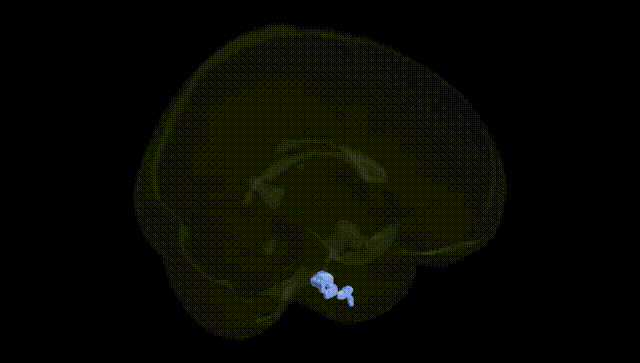 Full Brain Black