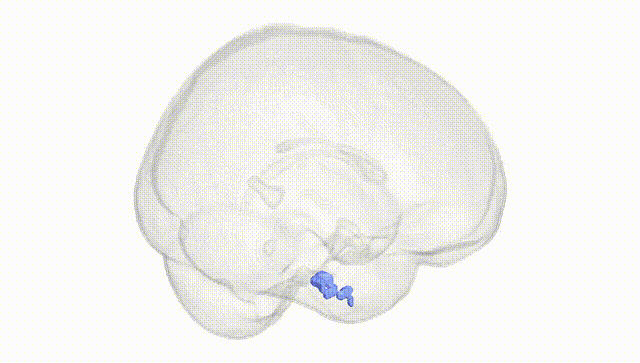 Full Brain White