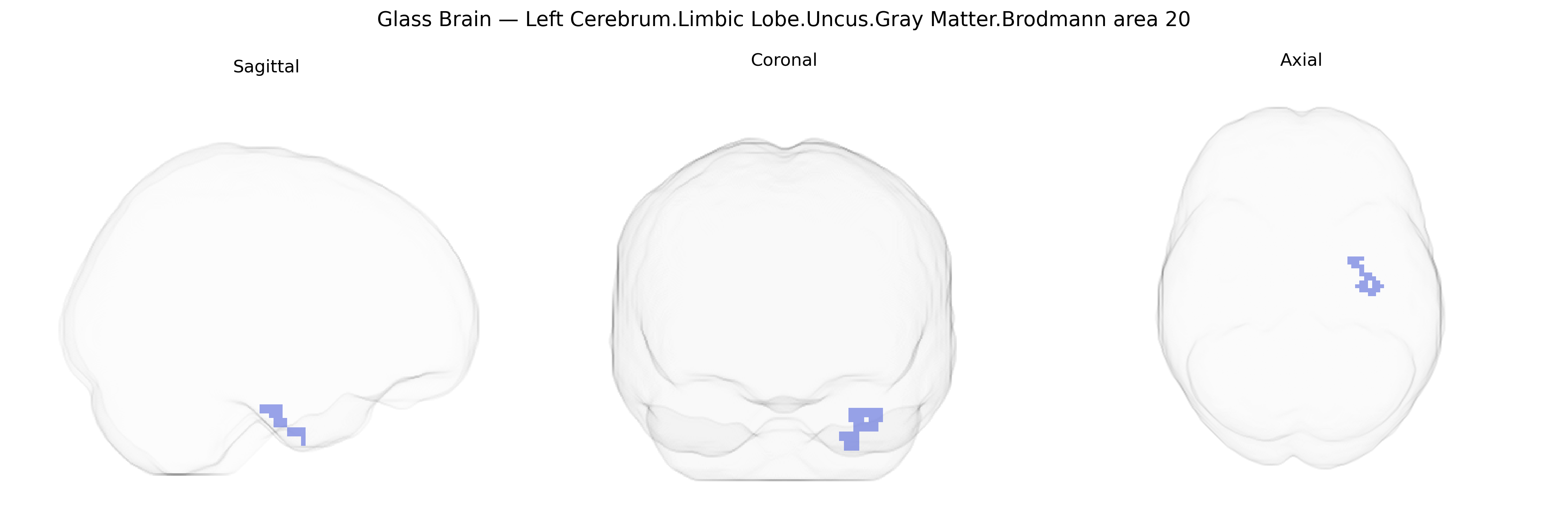 Triplanar Ghost Brain