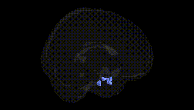 Full Brain Black