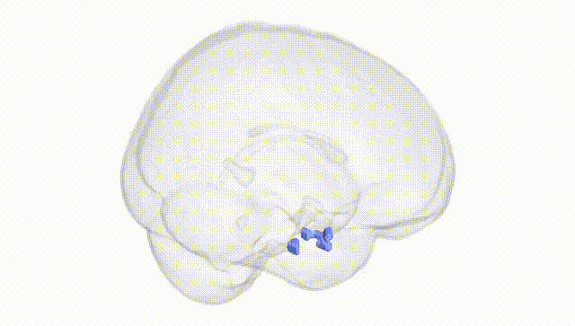 Full Brain White