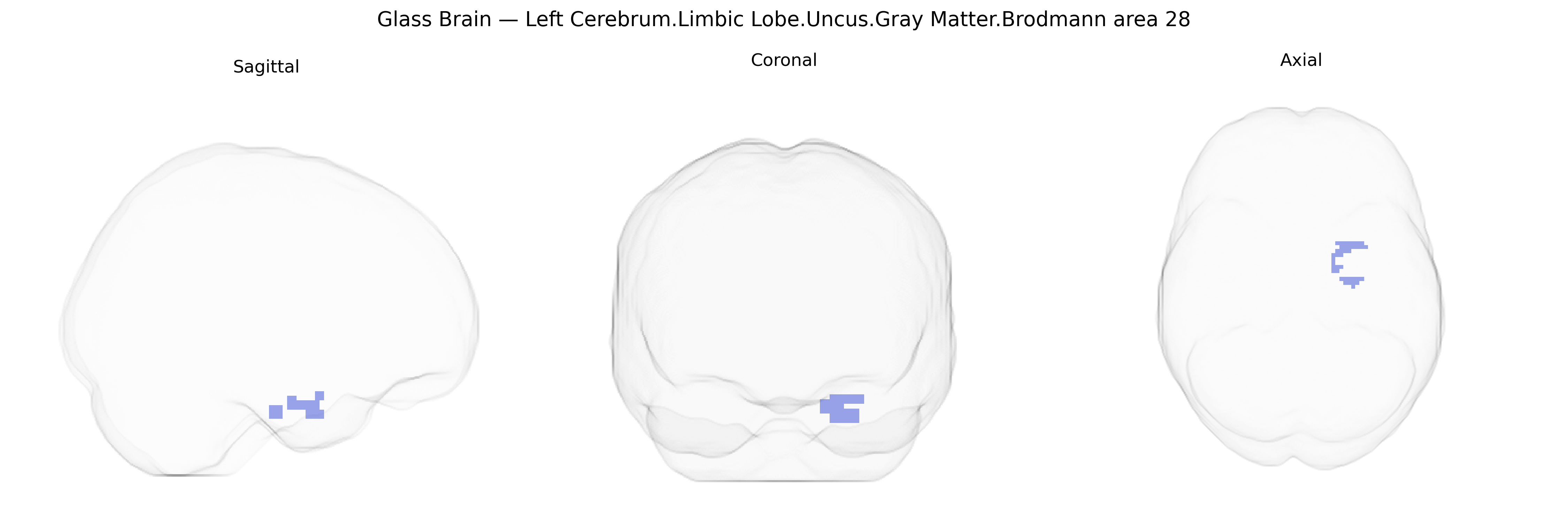 Triplanar Ghost Brain