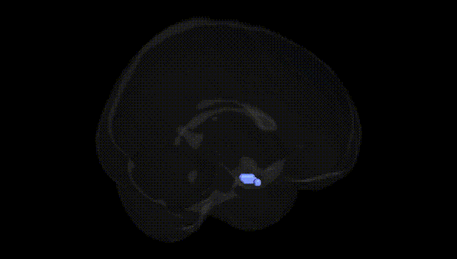 Full Brain Black