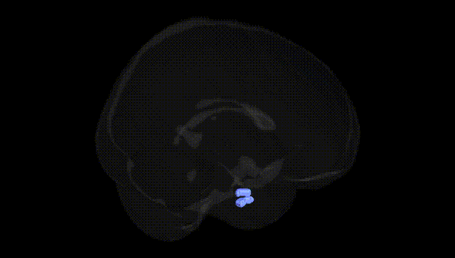 Full Brain Black