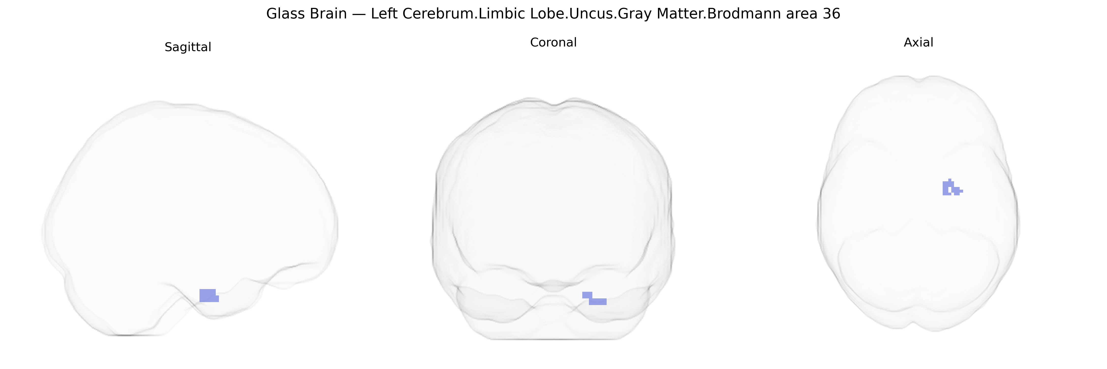 Triplanar Ghost Brain