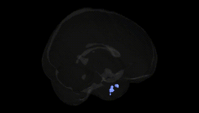 Full Brain Black