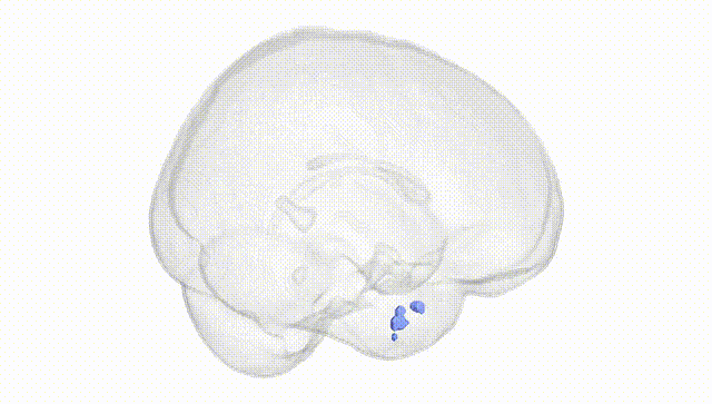 Full Brain White