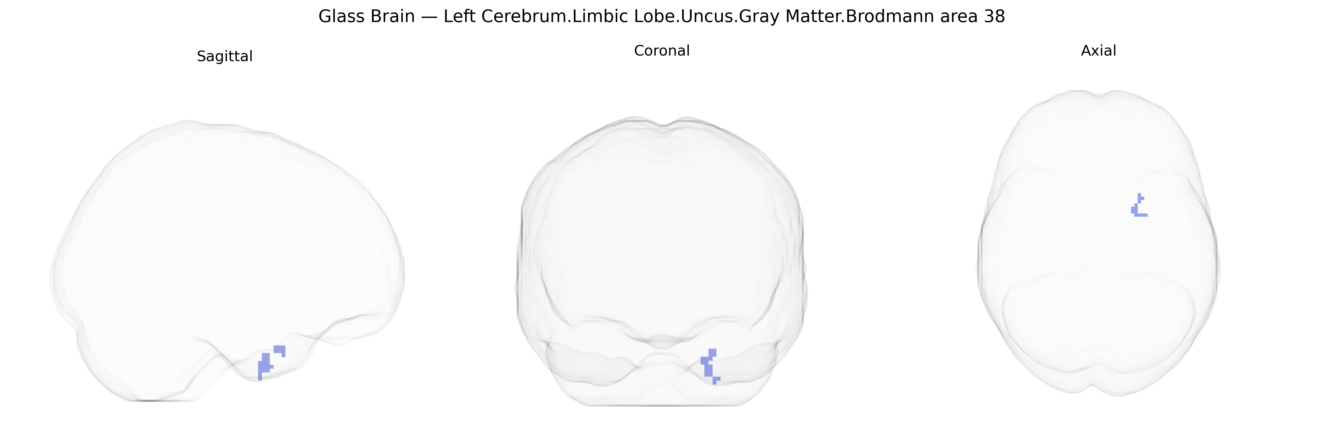 Triplanar Ghost Brain