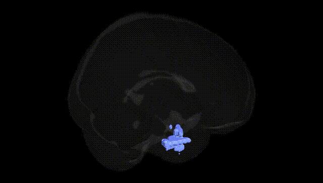 Full Brain Black