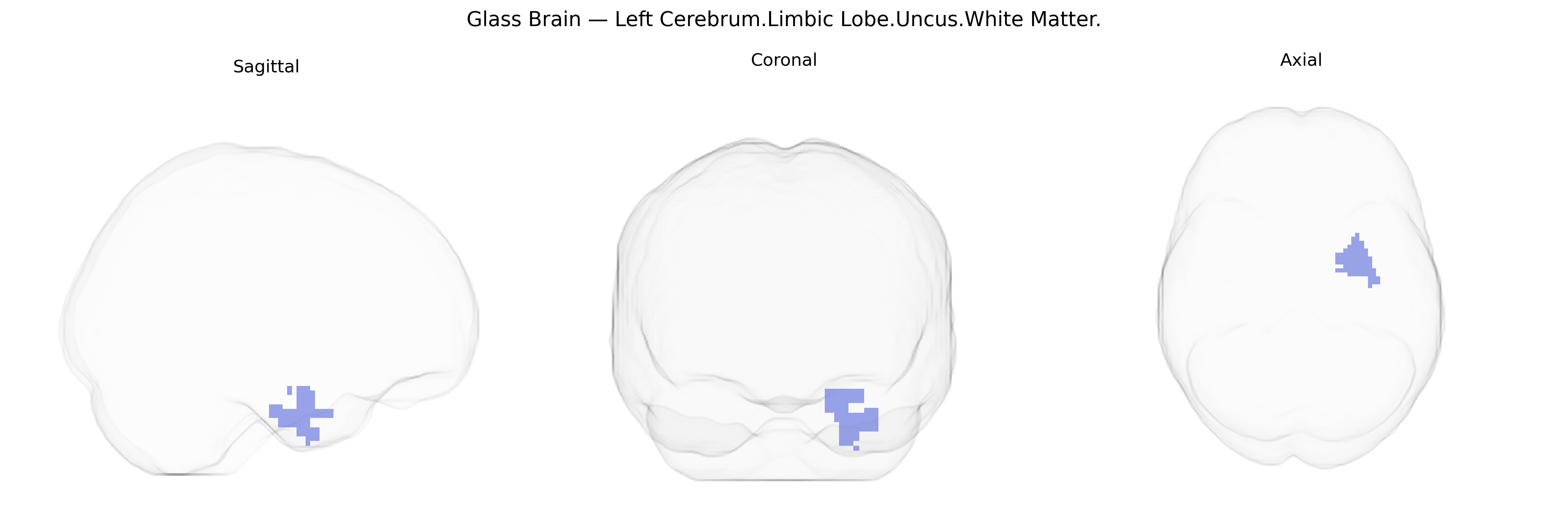 Triplanar Ghost Brain