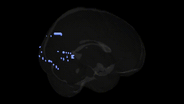 Full Brain Black