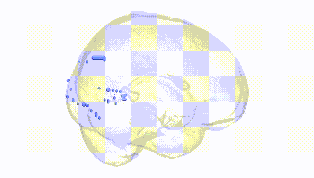 Full Brain White