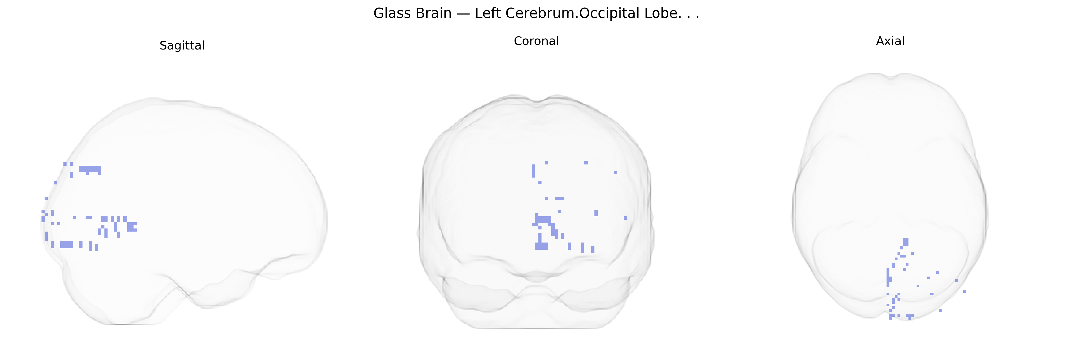 Triplanar Ghost Brain
