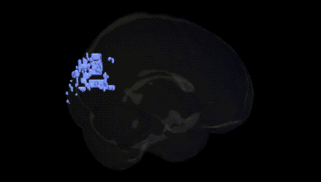 Full Brain Black