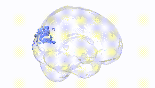 Full Brain White