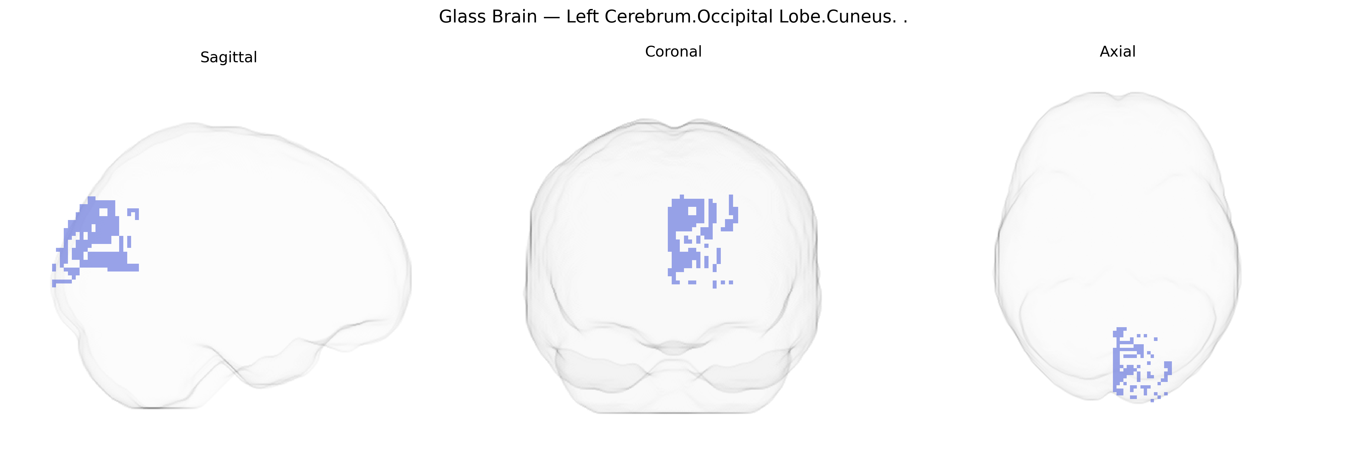 Triplanar Ghost Brain