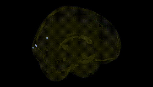 Full Brain Black