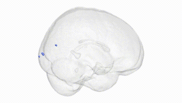 Full Brain White