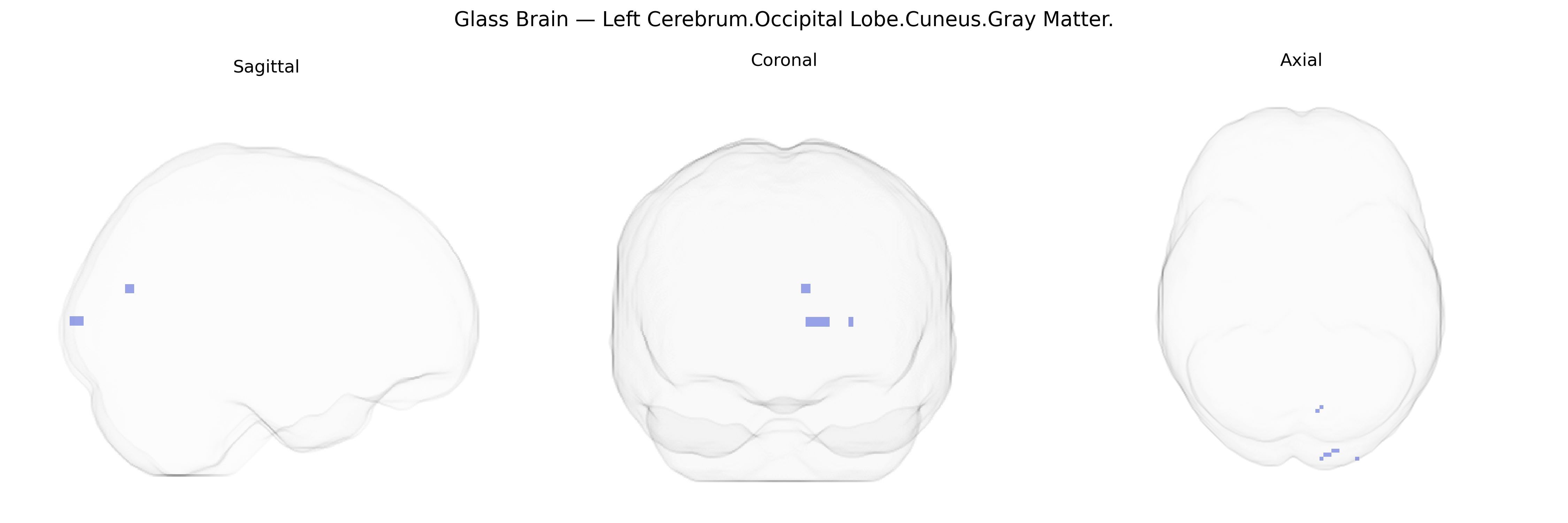 Triplanar Ghost Brain