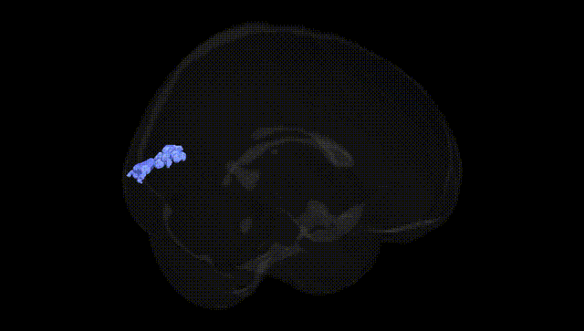 Full Brain Black