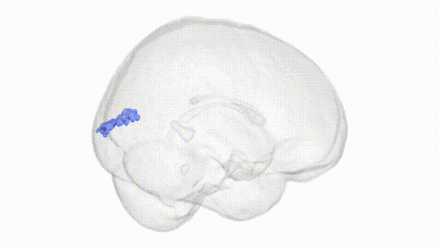 Full Brain White