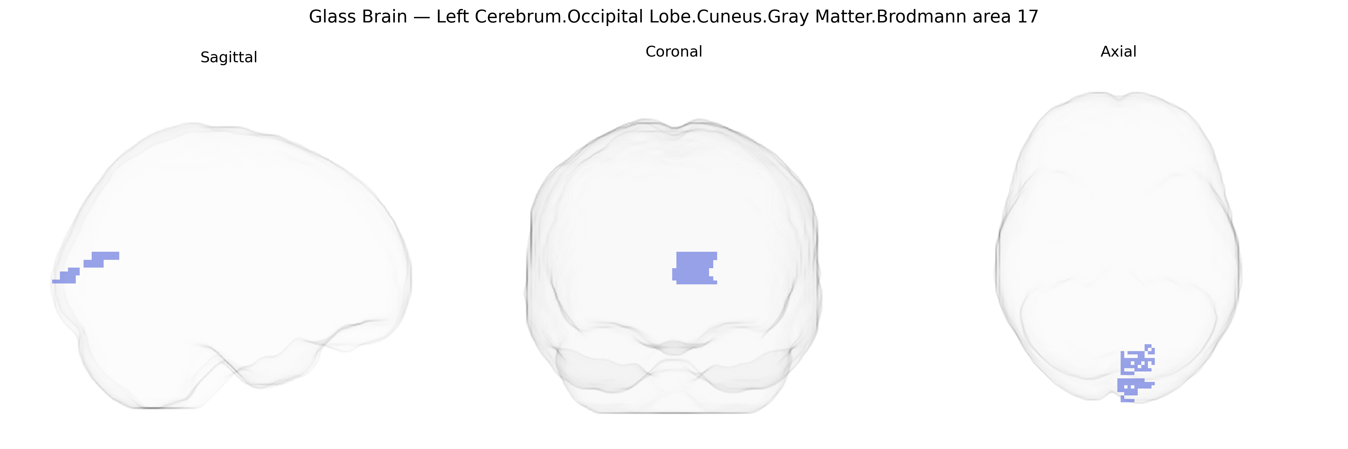 Triplanar Ghost Brain