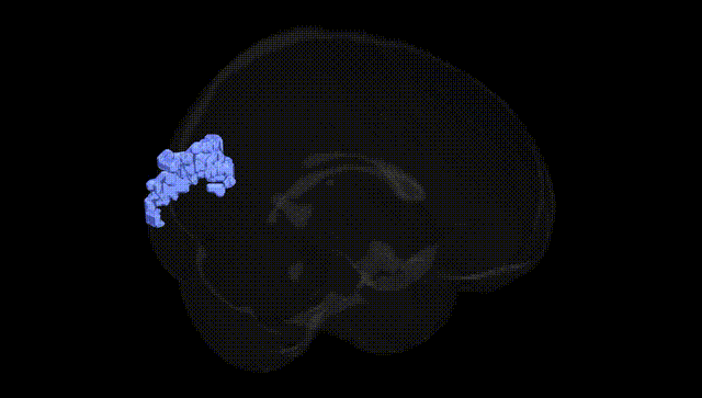 Full Brain Black