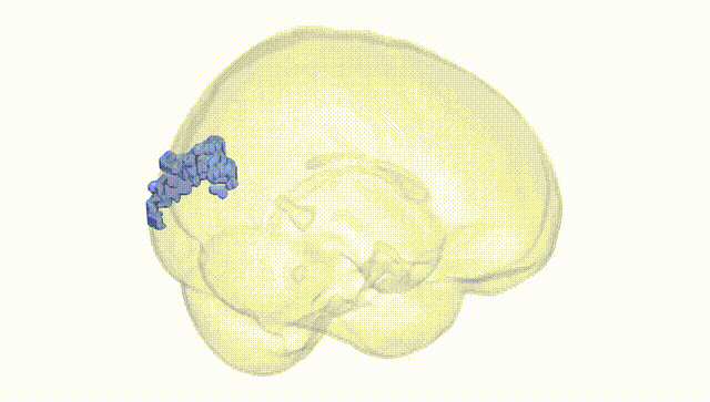 Full Brain White