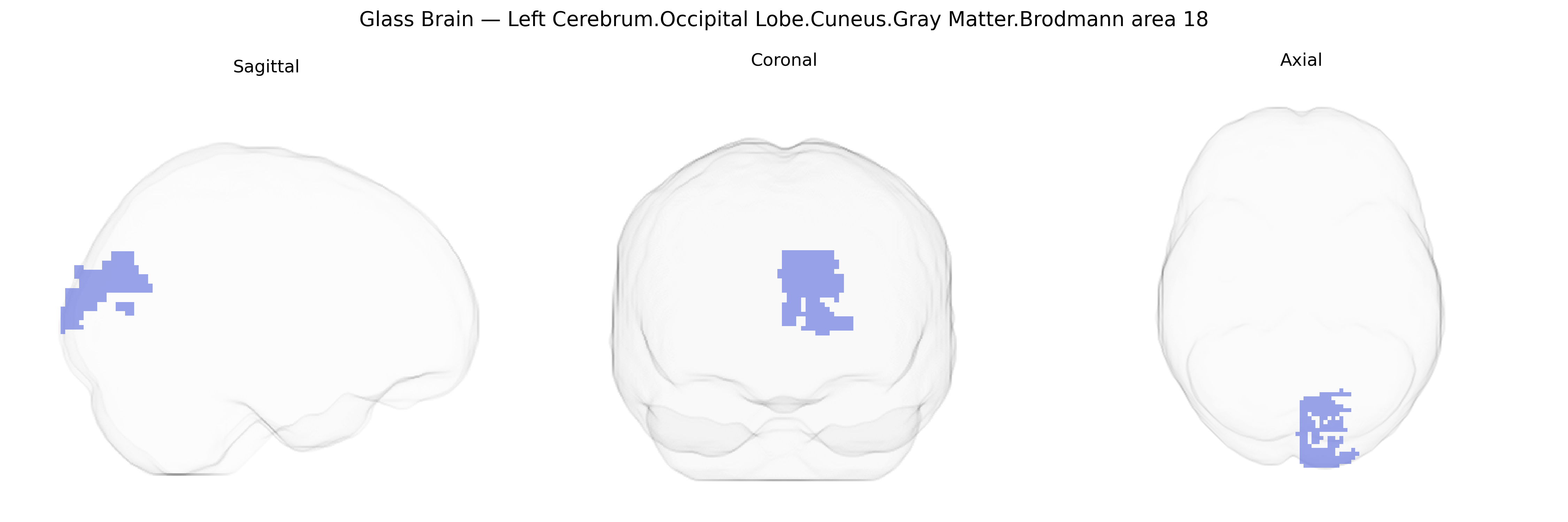 Triplanar Ghost Brain