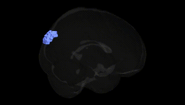Full Brain Black