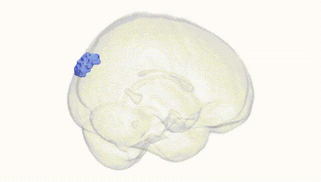 Full Brain White