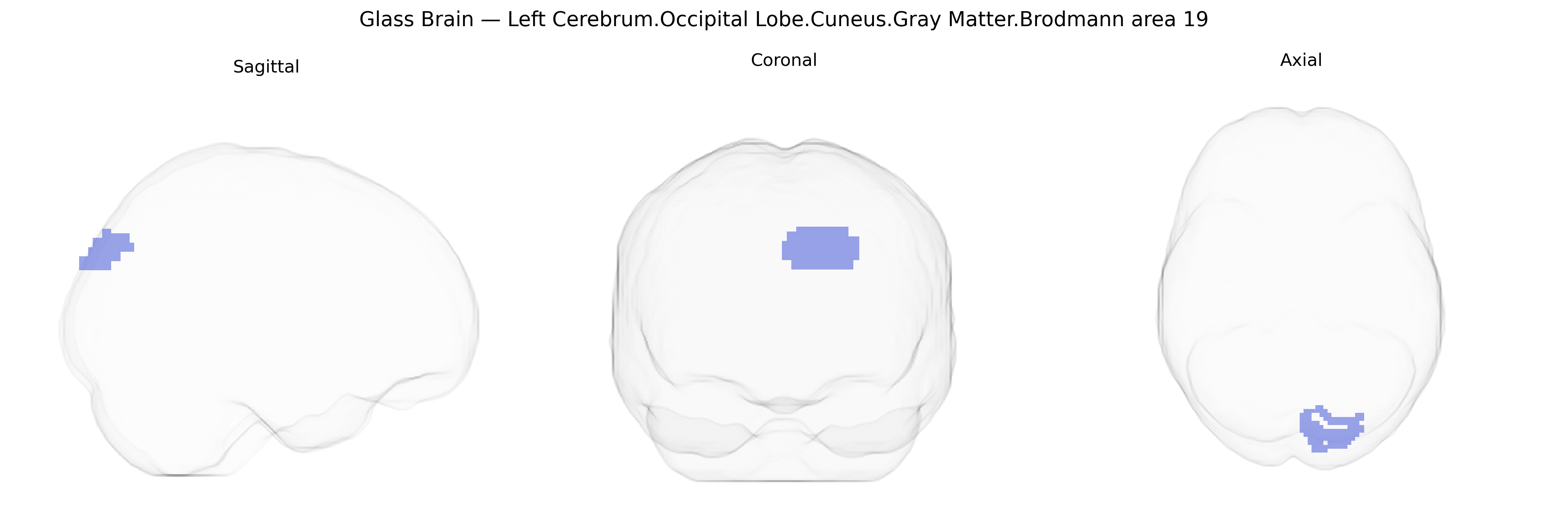Triplanar Ghost Brain