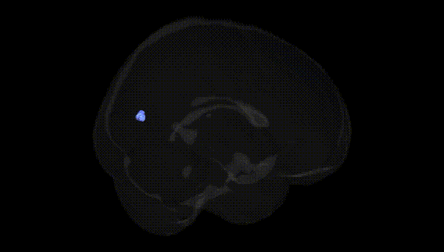 Full Brain Black