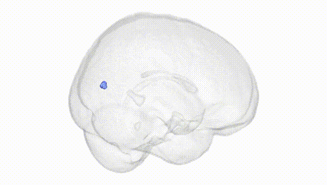 Full Brain White