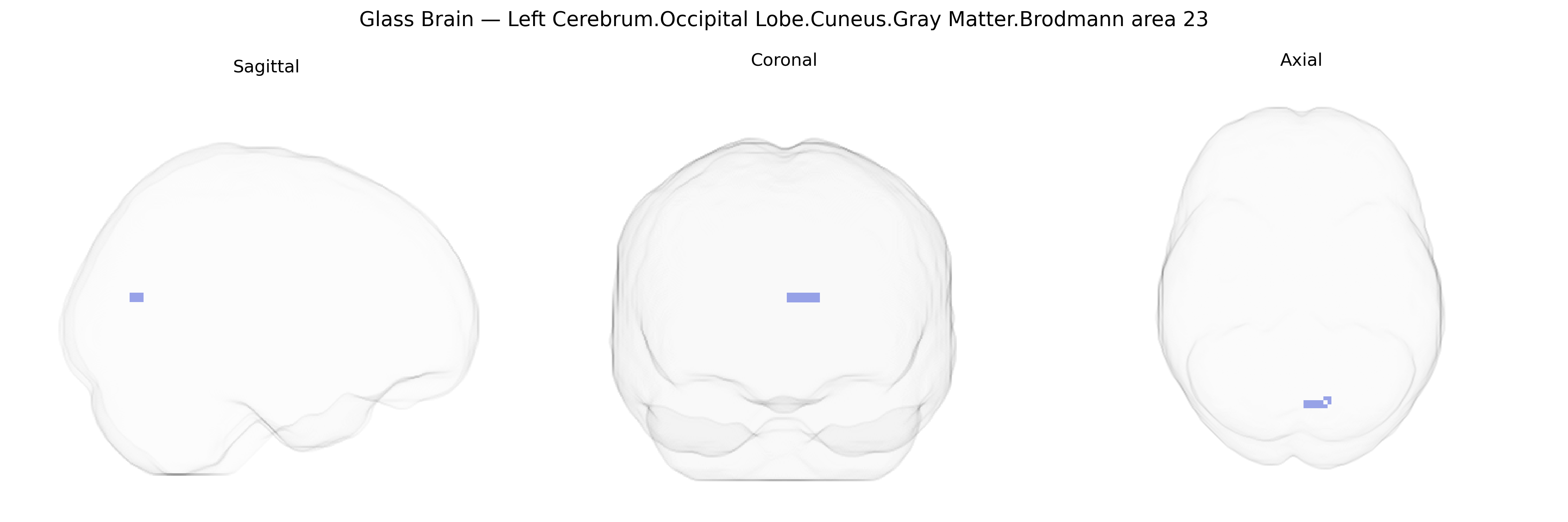 Triplanar Ghost Brain