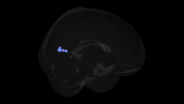 Full Brain Black
