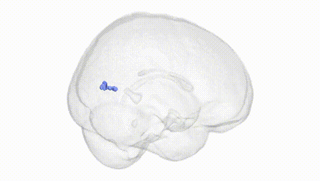 Full Brain White