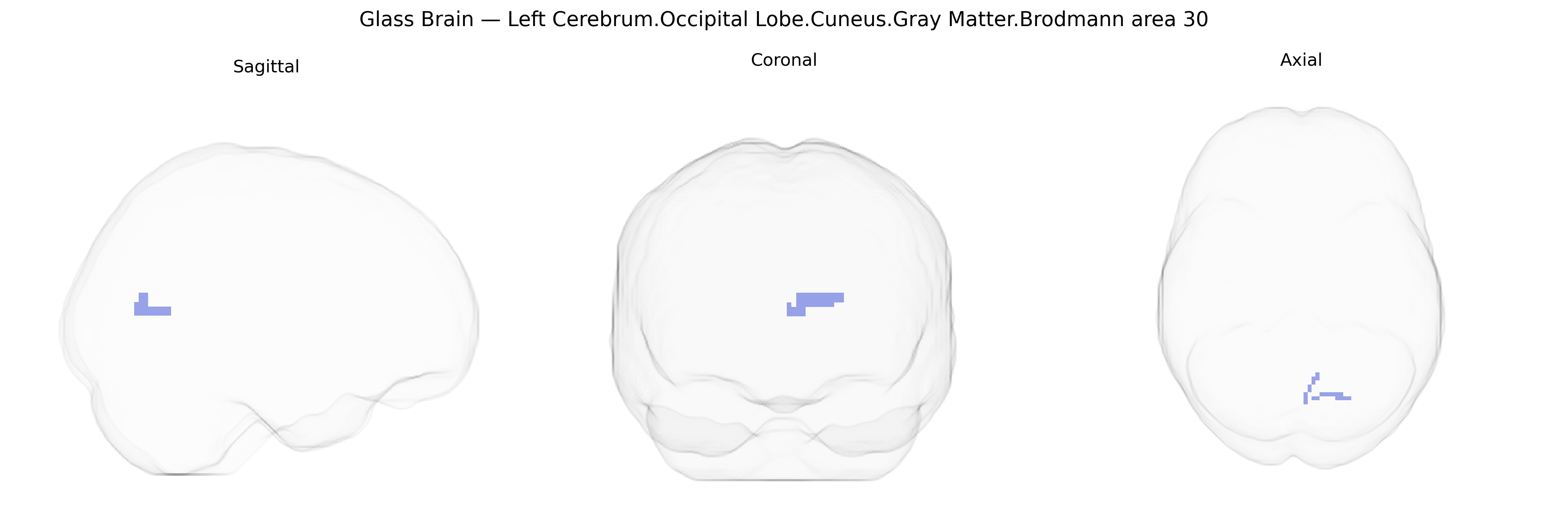 Triplanar Ghost Brain