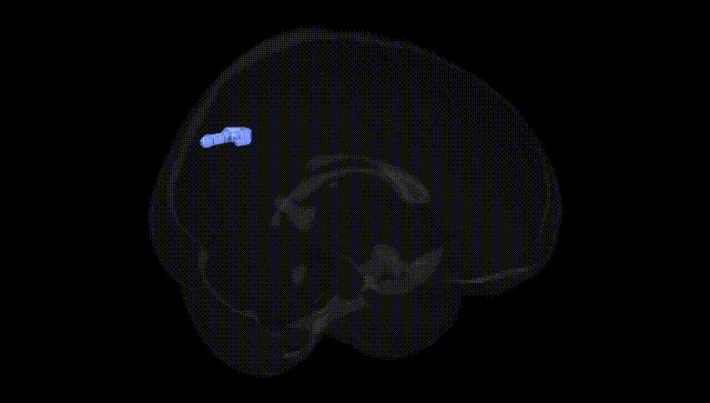 Full Brain Black